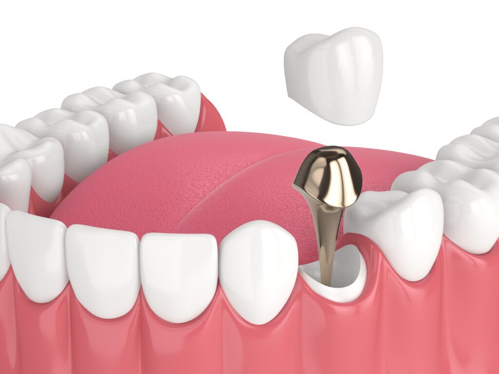 Dentist in Newburgh