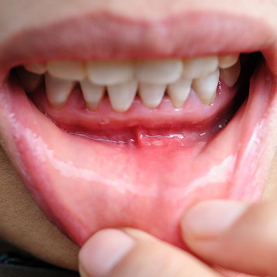 Dentist in Newburgh